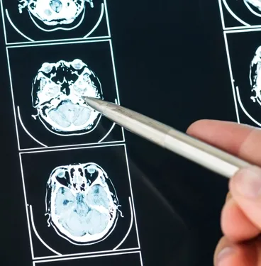 Neurologie